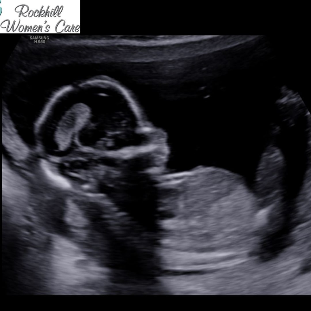 Photo shared by Sydnee for their Babylist baby registry.