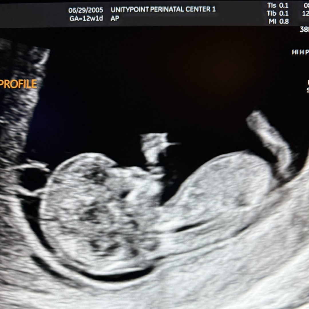 Photo shared by Jordan for their Babylist baby registry.