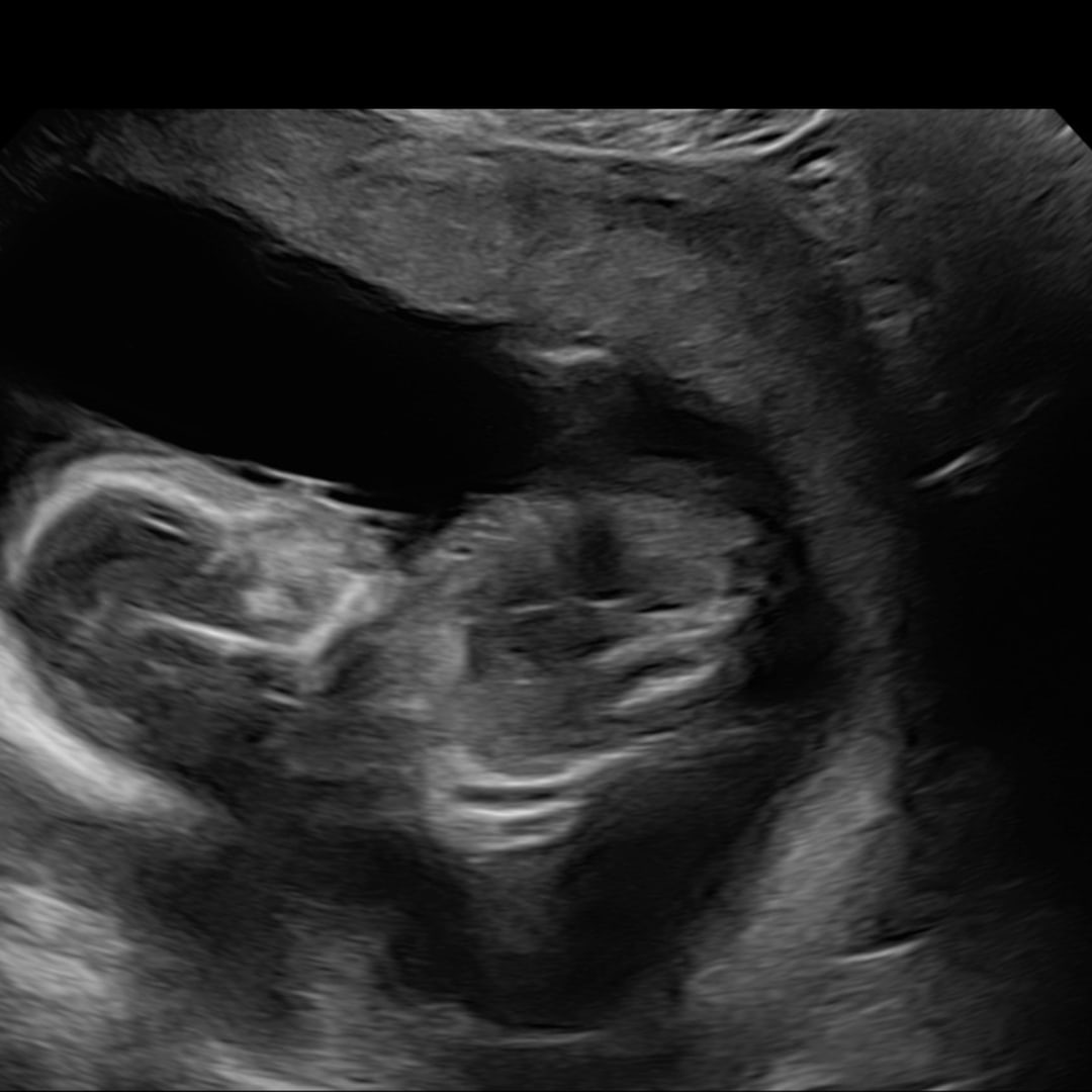 Photo shared by Shanerica for their Babylist baby registry.