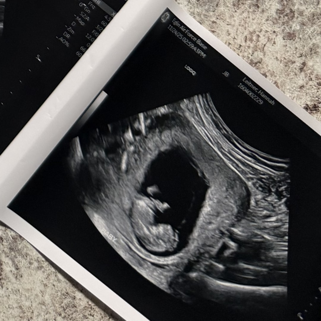 Photo shared by Hannah for their Babylist baby registry.