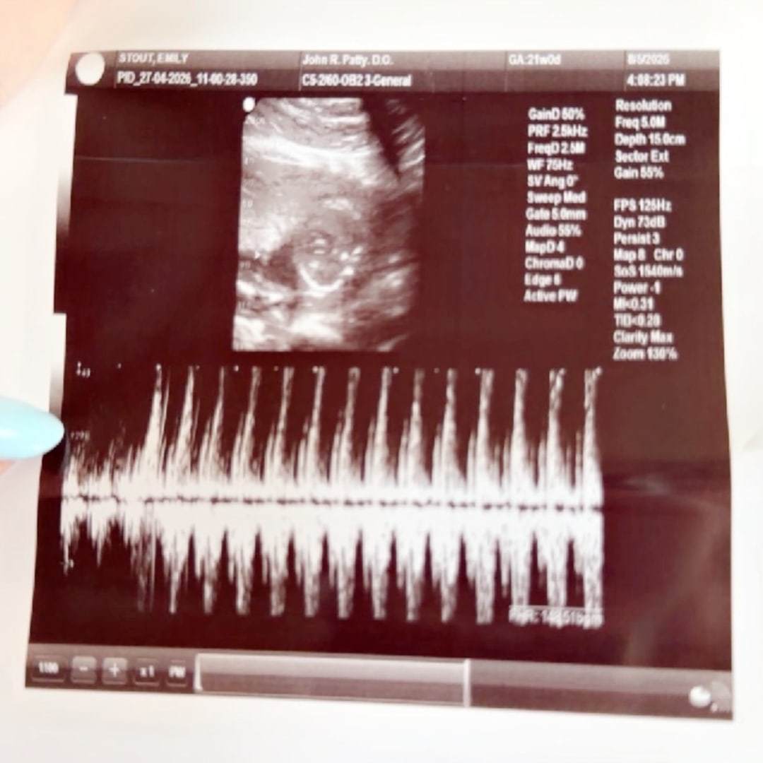 Photo shared by Emily for their Babylist baby registry.