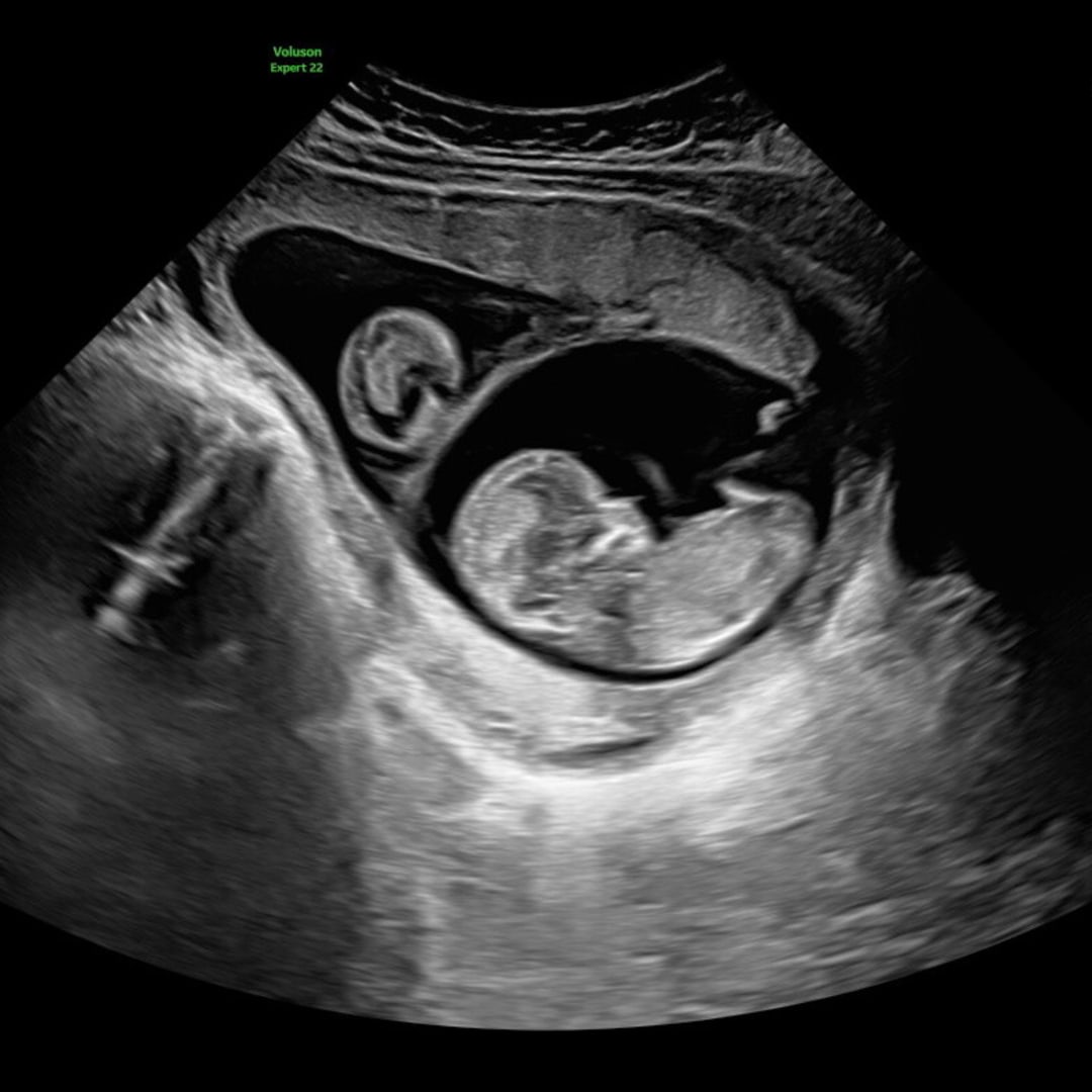 Photo shared by Braden for their Babylist baby registry.