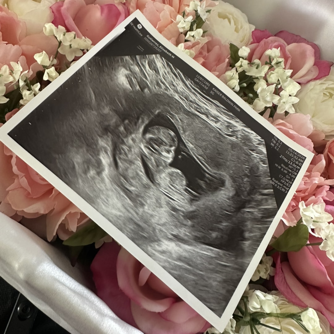 Photo shared by Elizabeth for their Babylist baby registry.