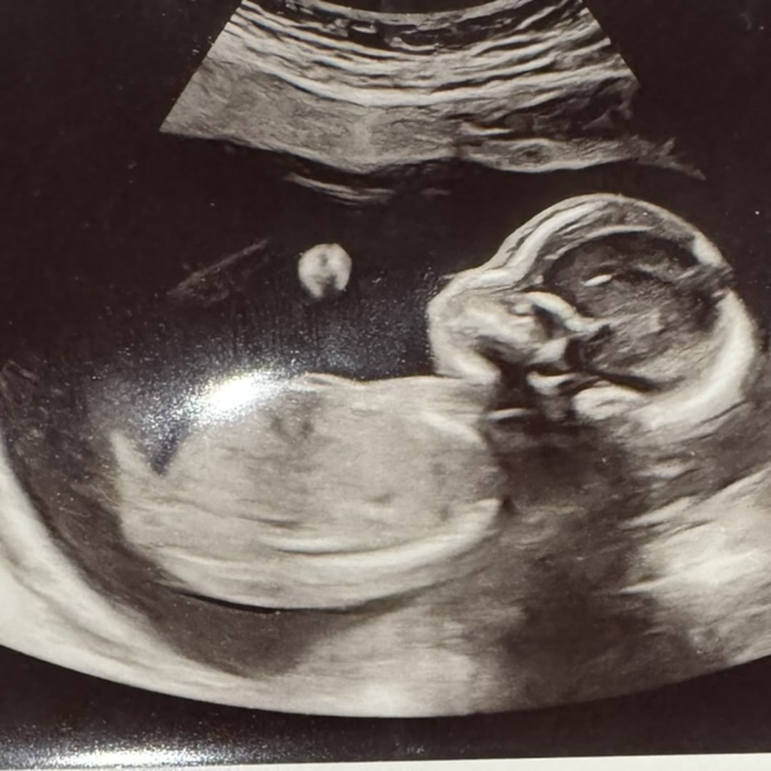 Photo shared by Brielle for their Babylist baby registry.
