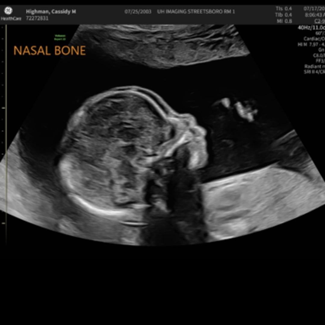 Photo shared by Cassidy for their Babylist baby registry.