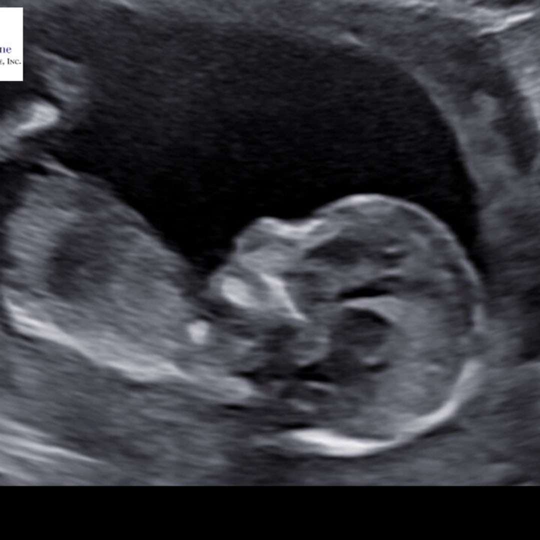 Photo shared by Brittany for their Babylist baby registry.