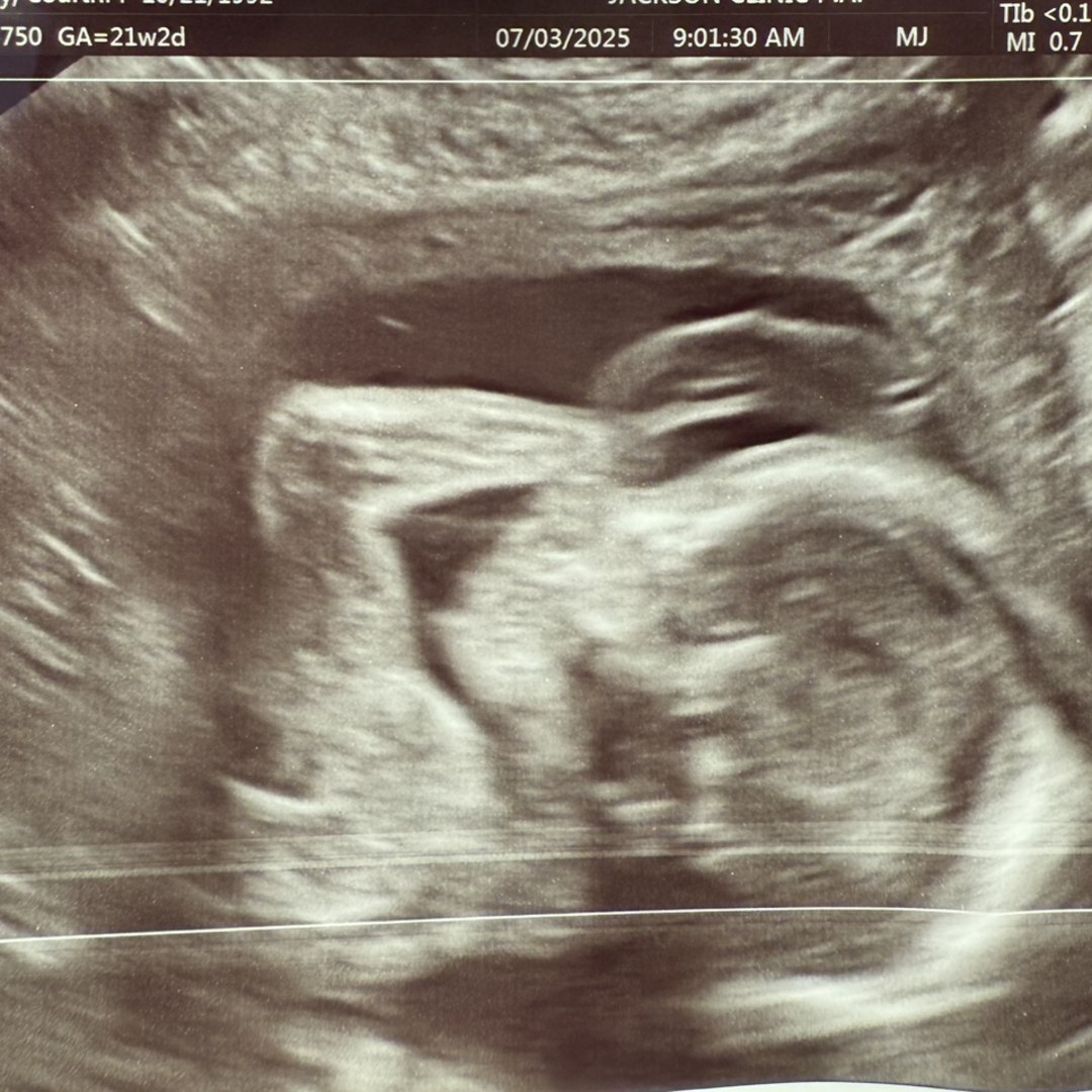 Photo shared by Courtni for their Babylist baby registry.