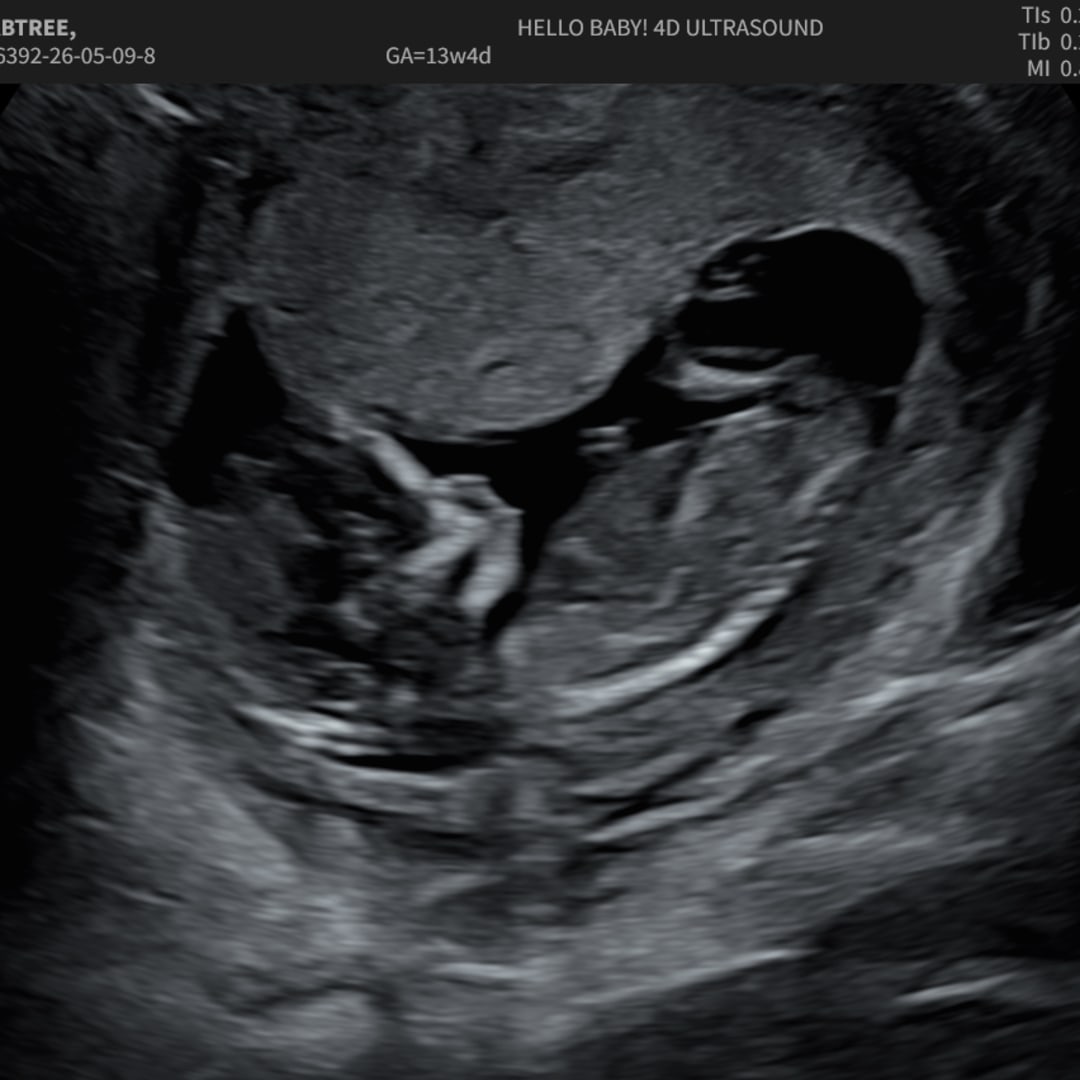 Photo shared by Chloe for their Babylist baby registry.