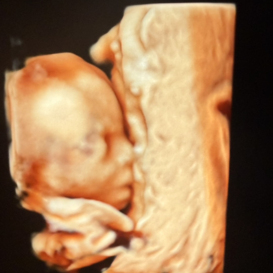 Photo shared by Gary for their Babylist baby registry.