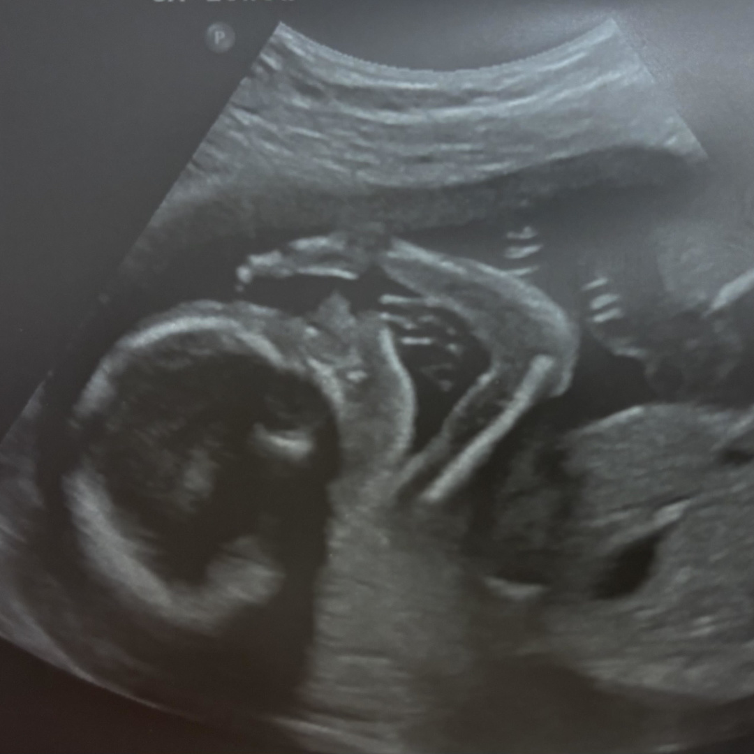 Photo shared by Cort for their Babylist baby registry.