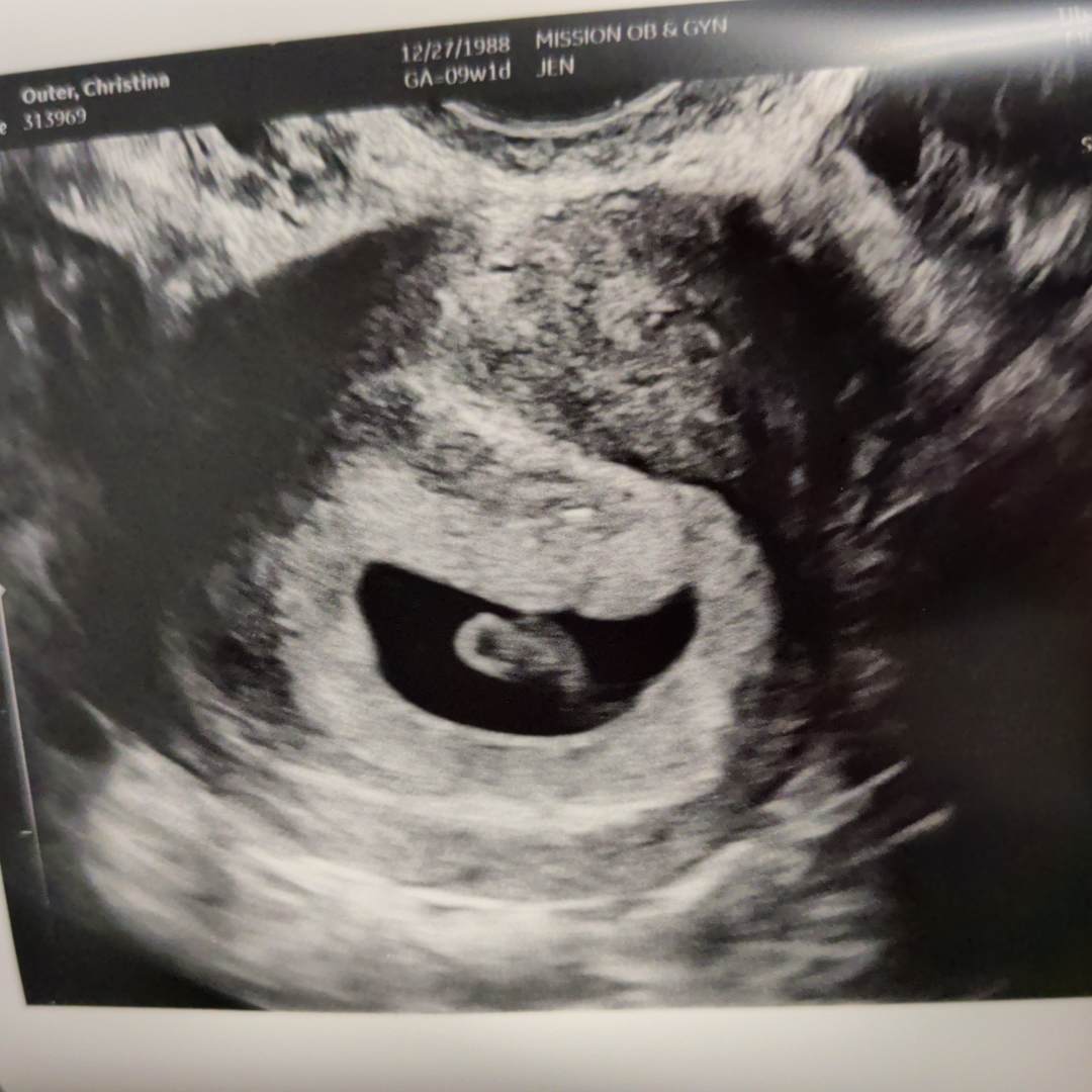 Photo shared by Christina for their Babylist baby registry.