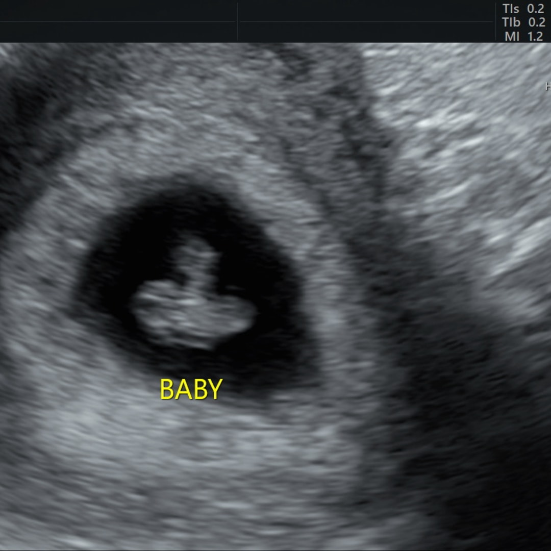 Photo shared by Andrianna for their Babylist baby registry.
