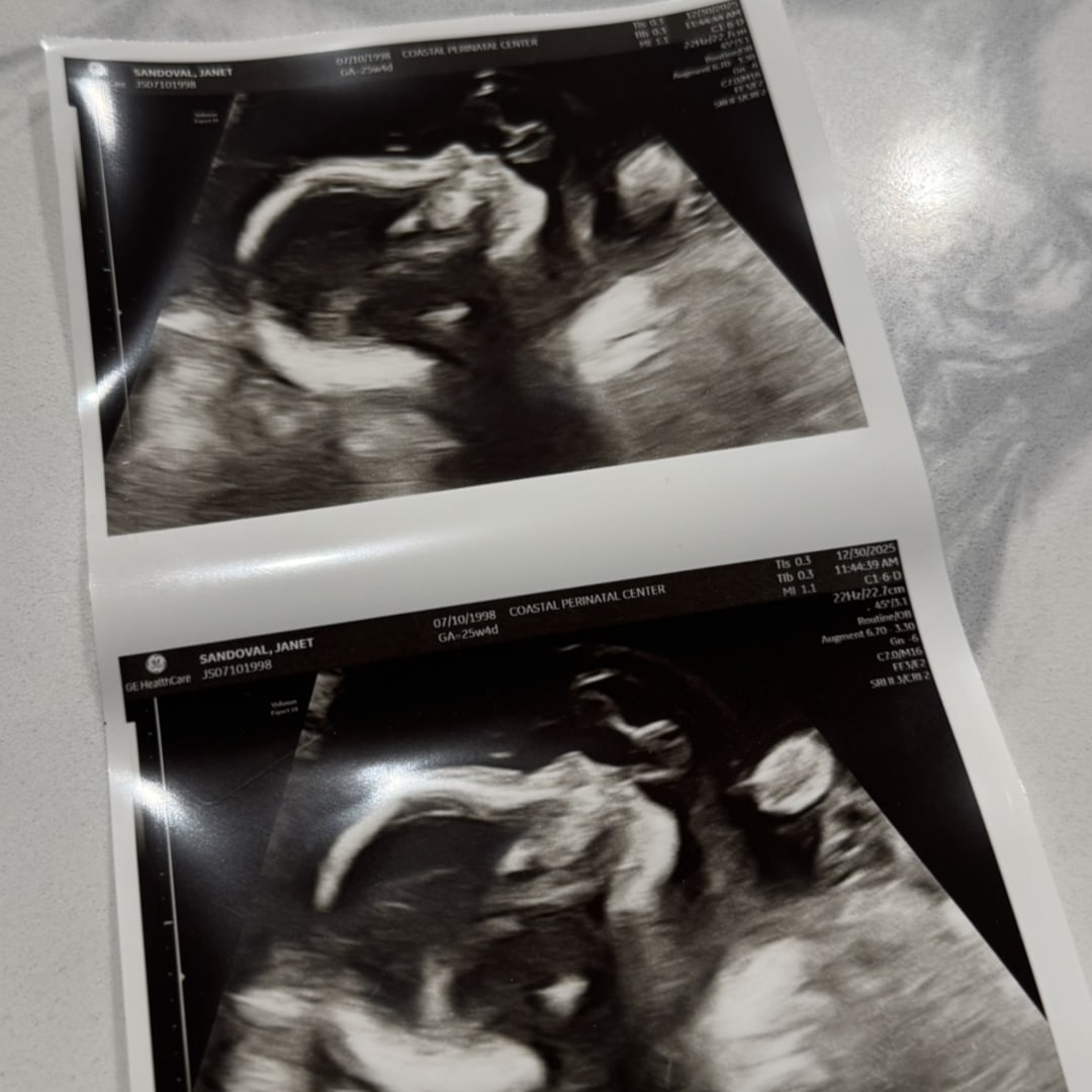 Photo shared by Janet for their Babylist baby registry.