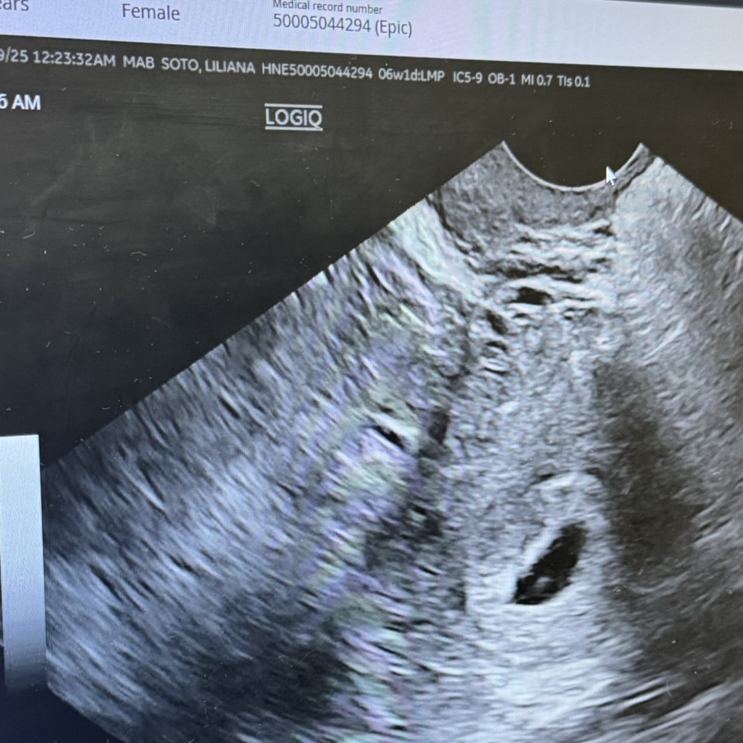 Photo shared by Liliana for their Babylist baby registry.