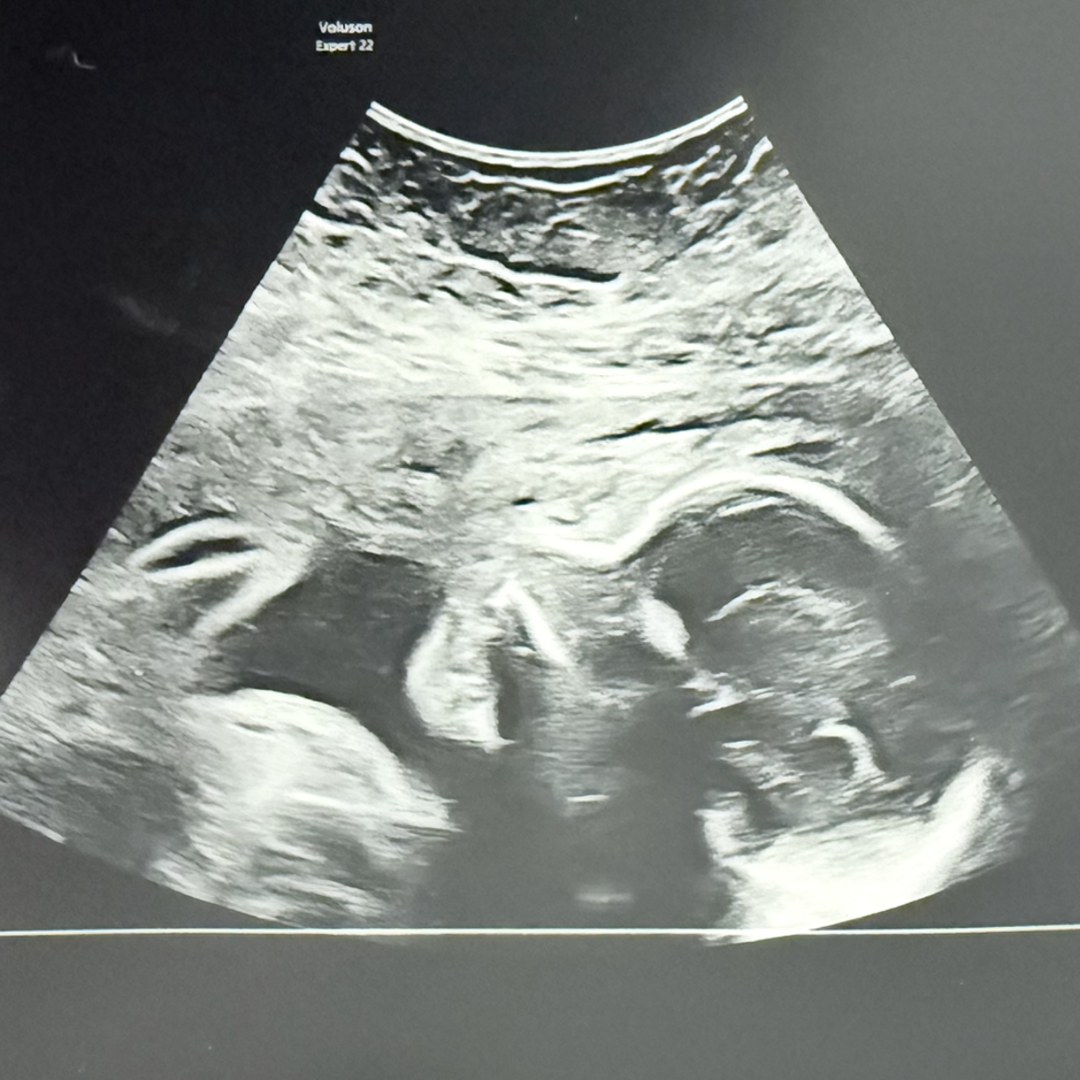 Photo shared by Rachel for their Babylist baby registry.