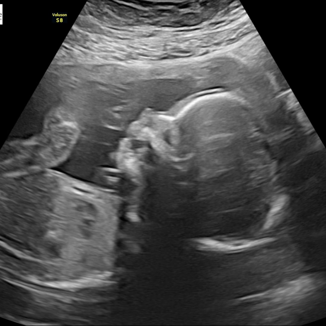 Photo shared by Samantha for their Babylist baby registry.