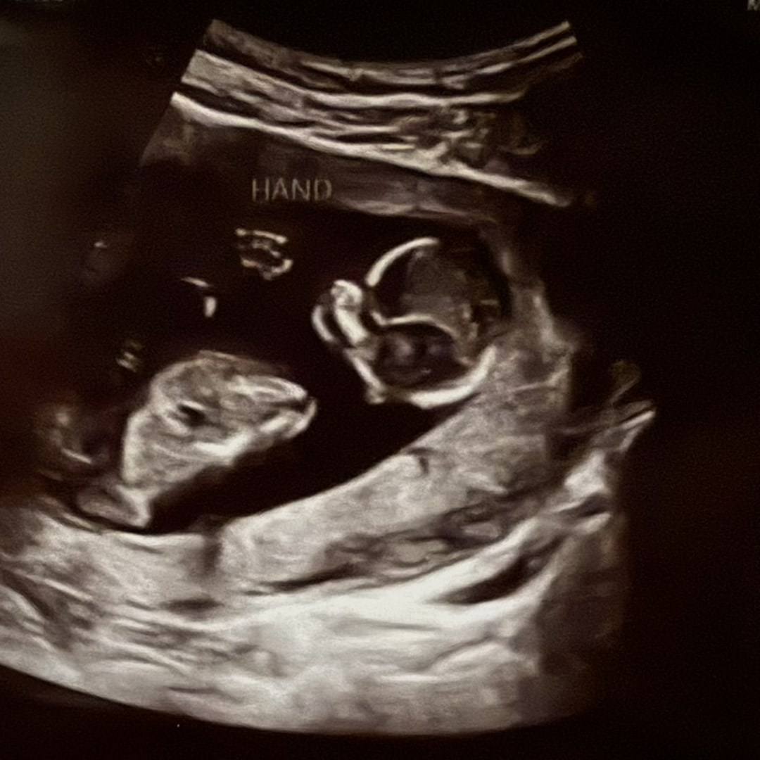Photo shared by Cory for their Babylist baby registry.