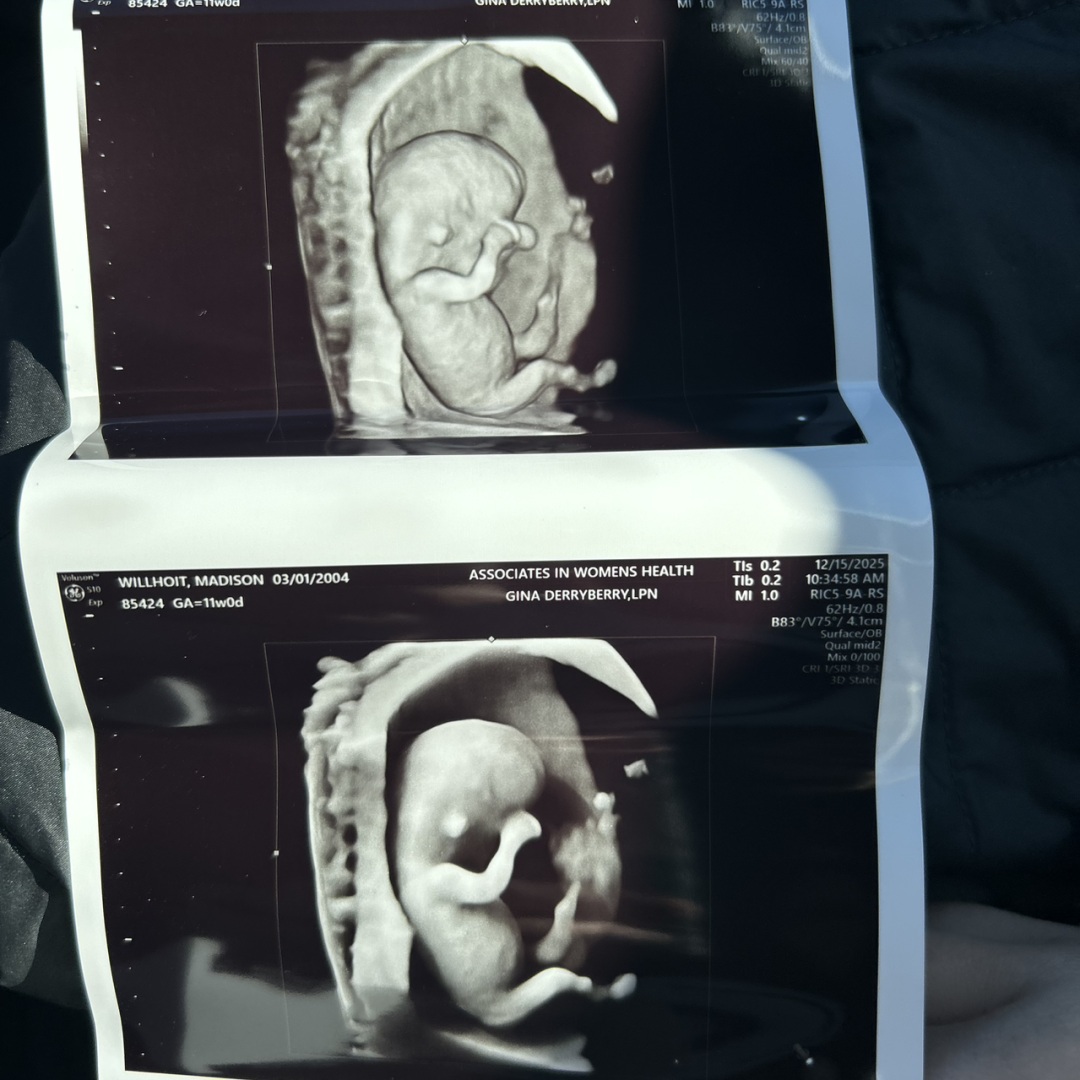 Photo shared by Madison for their Babylist baby registry.