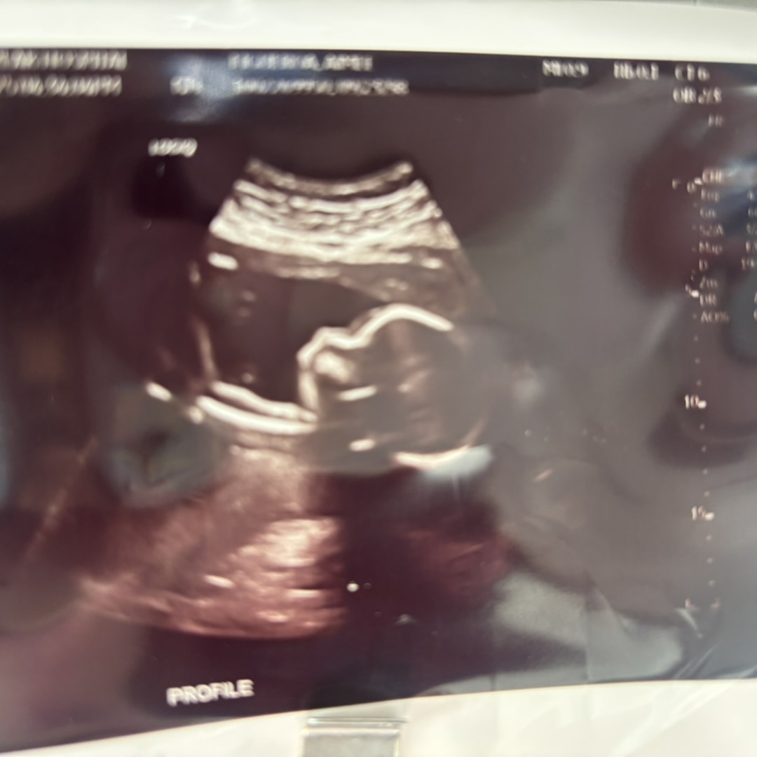 Photo shared by Aimee for their Babylist baby registry.