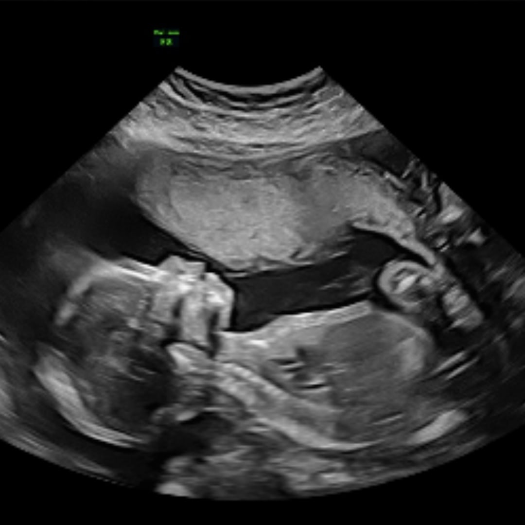 Photo shared by Chella for their Babylist baby registry.