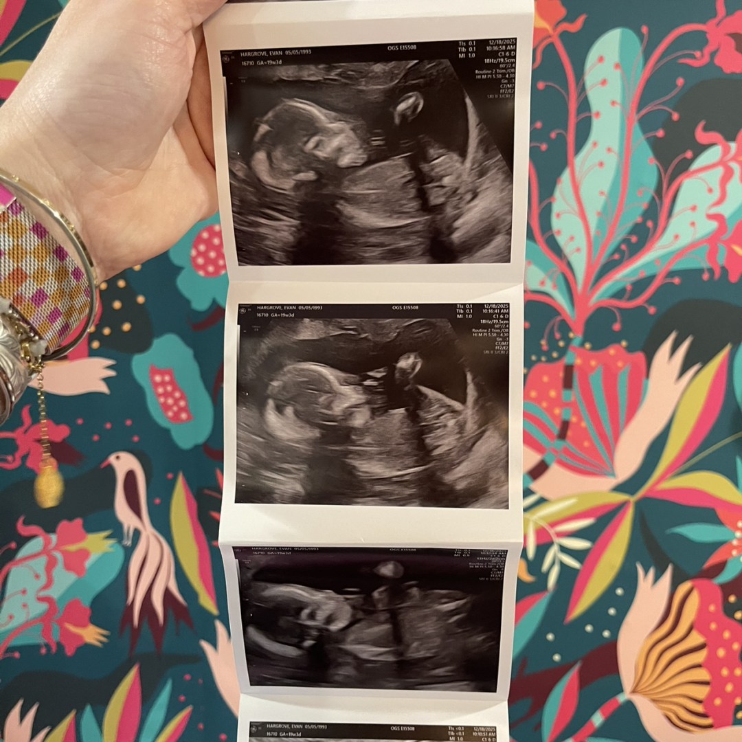 Photo shared by Evan for their Babylist baby registry.