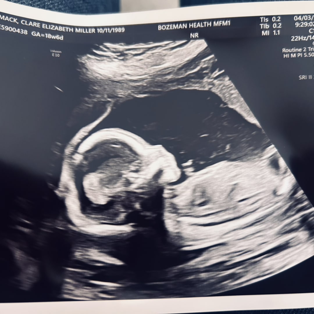 Photo shared by Clare for their Babylist baby registry.