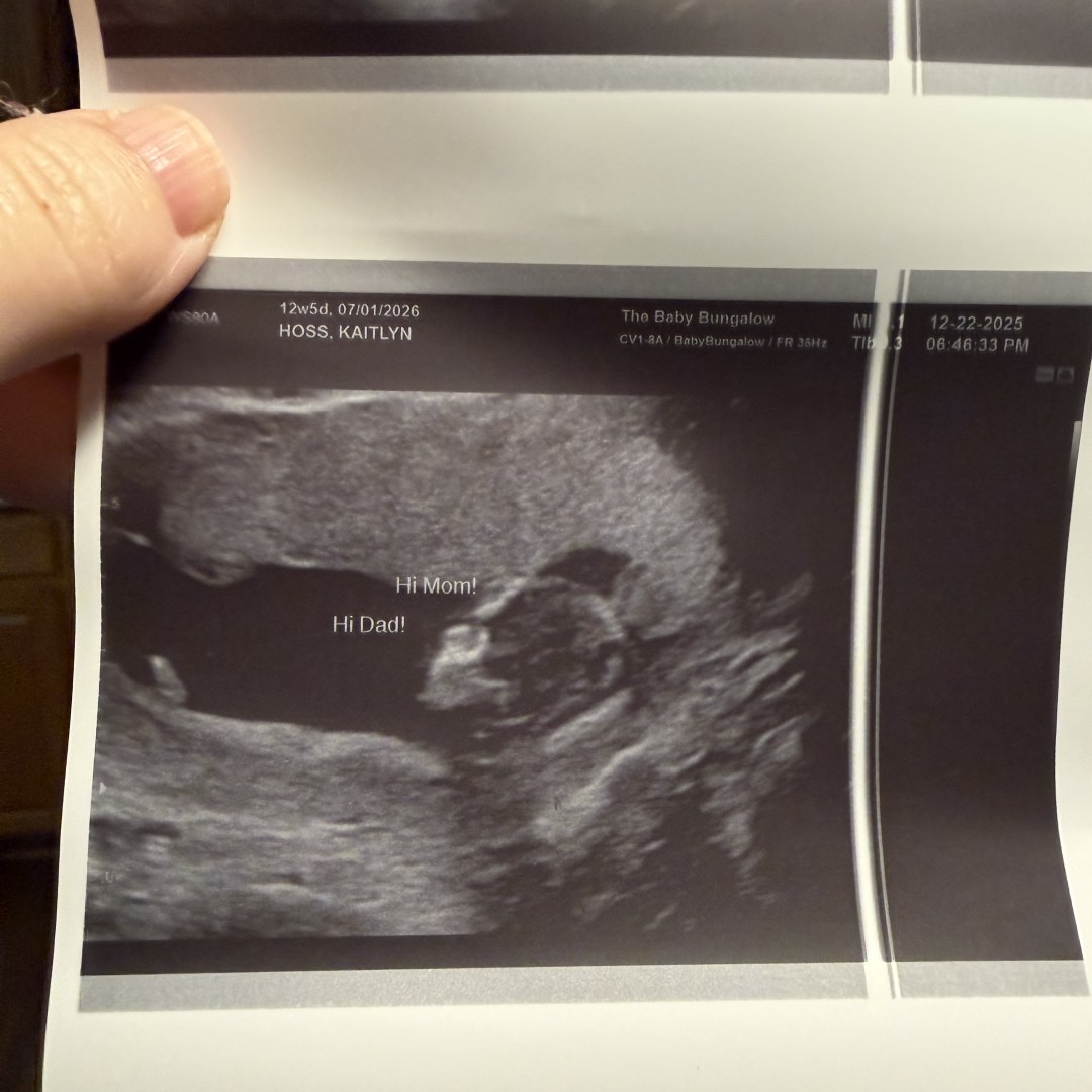 Photo shared by Kate&Dan for their Babylist baby registry.