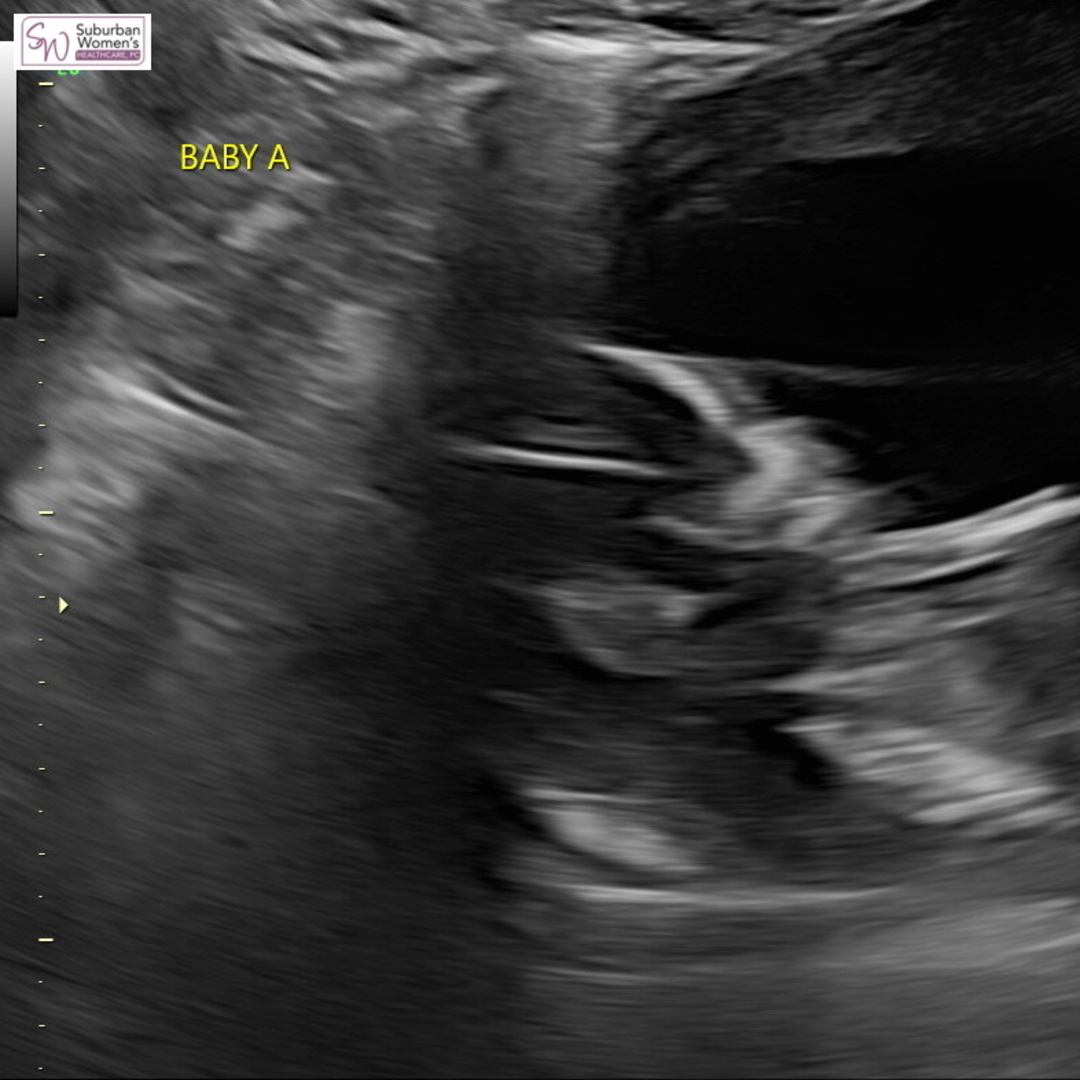 Photo shared by Olivia for their Babylist baby registry.