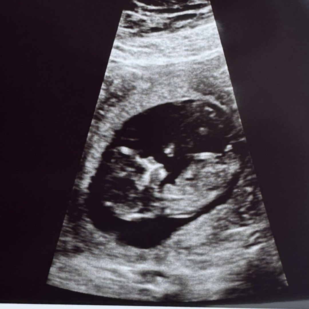 Photo shared by Brianna for their Babylist baby registry.