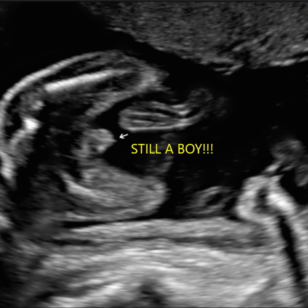 Photo shared by Shae for their Babylist baby registry.