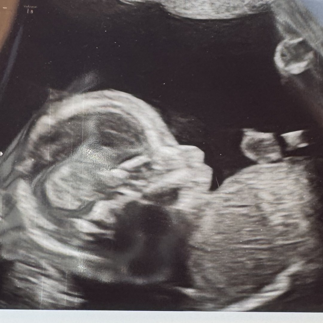 Photo shared by Lauren for their Babylist baby registry.