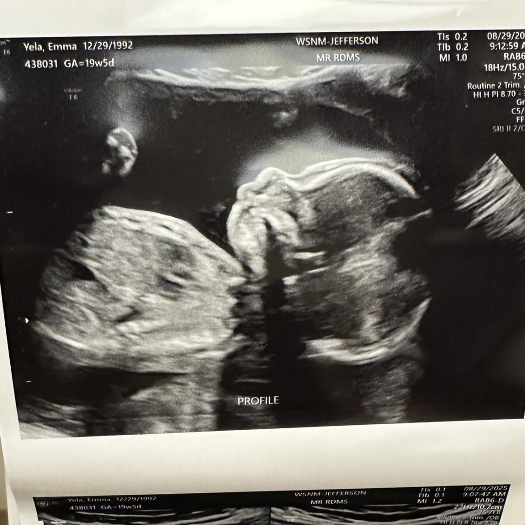 Photo shared by Emma for their Babylist baby registry.