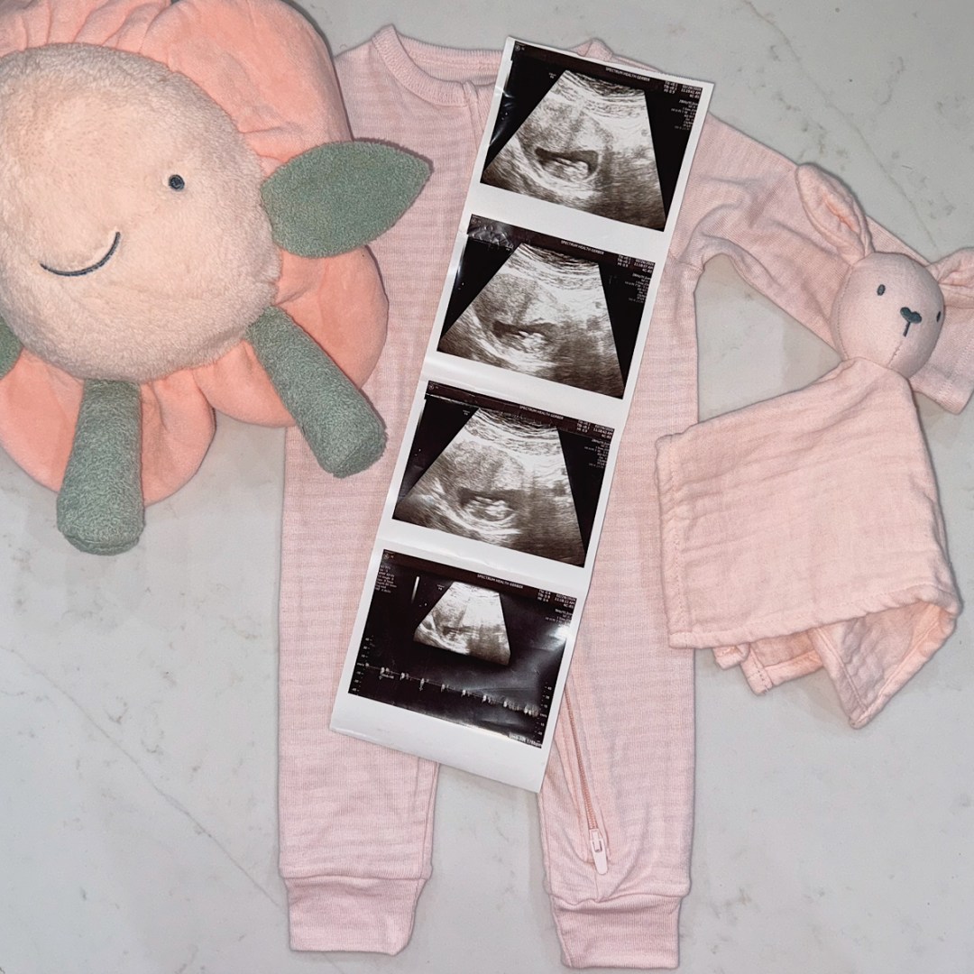Photo shared by Brooklyn for their Babylist baby registry.