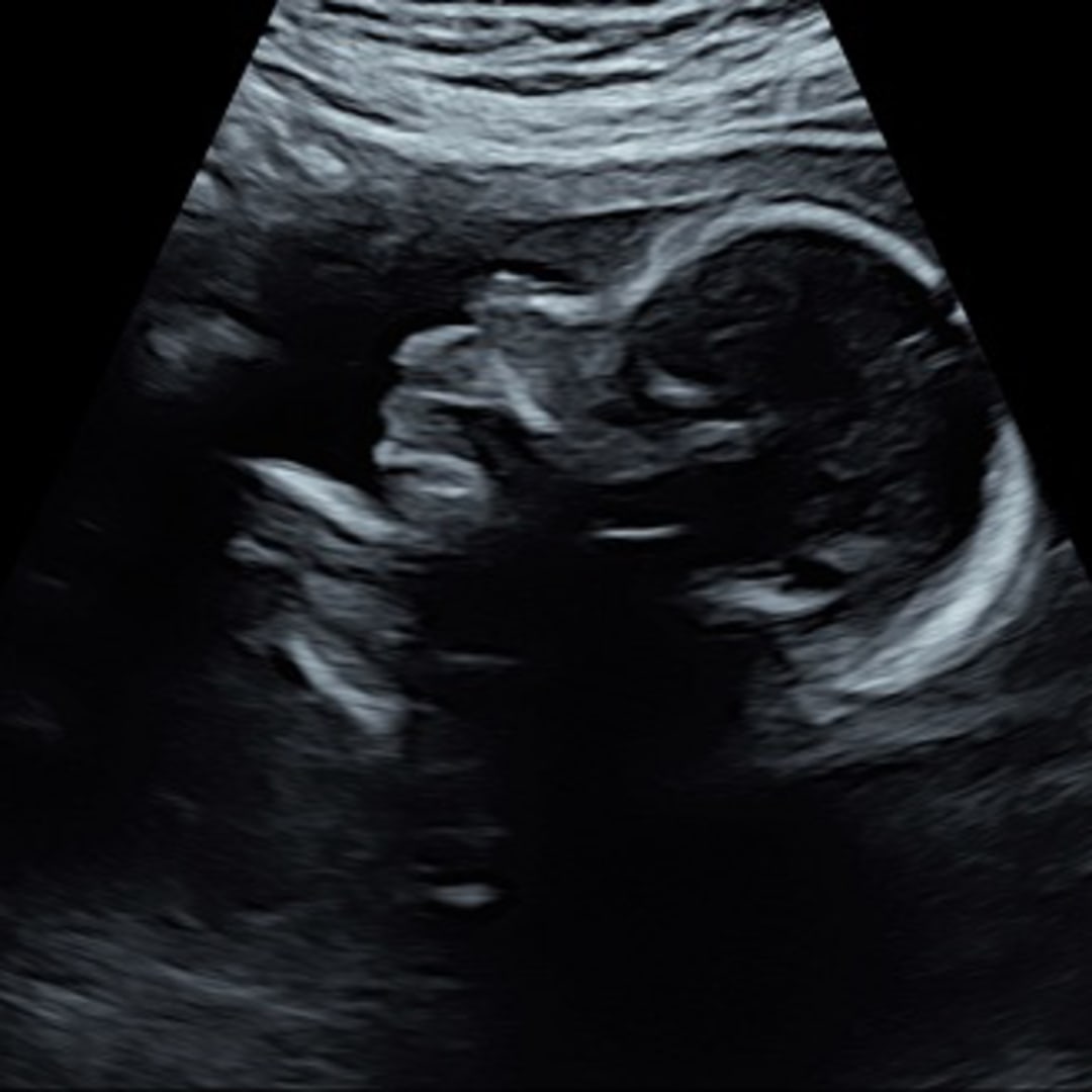 Photo shared by Alissa for their Babylist baby registry.