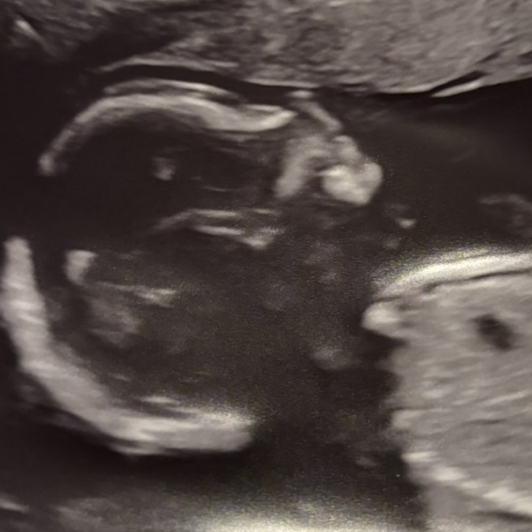 Photo shared by Ella for their Babylist baby registry.