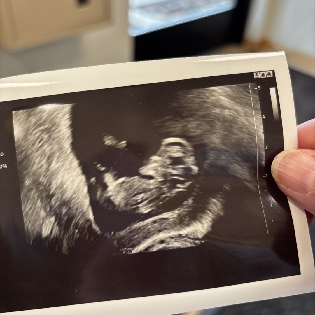 Photo shared by Bethany for their Babylist baby registry.