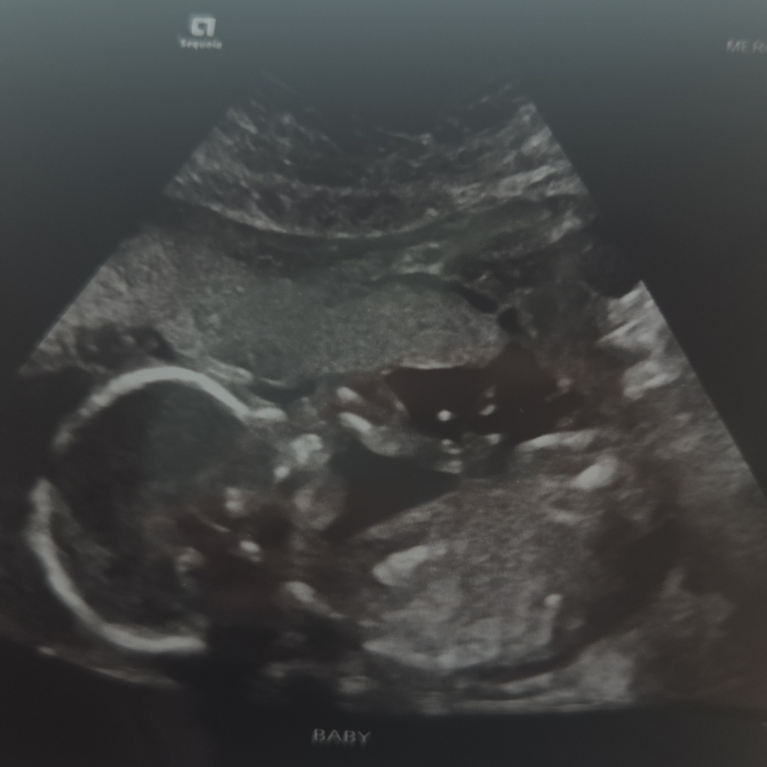 Photo shared by Erin for their Babylist baby registry.