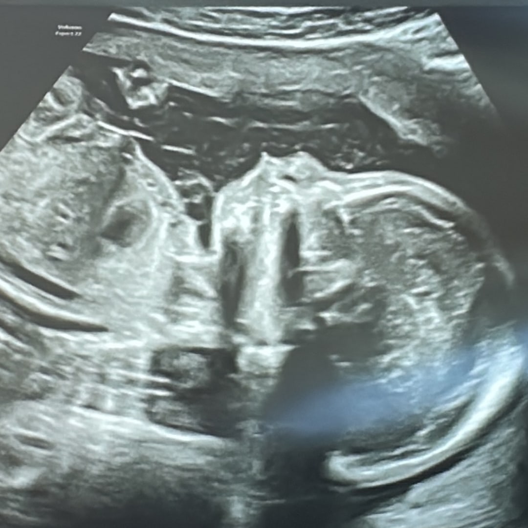 Photo shared by Jocelin for their Babylist baby registry.