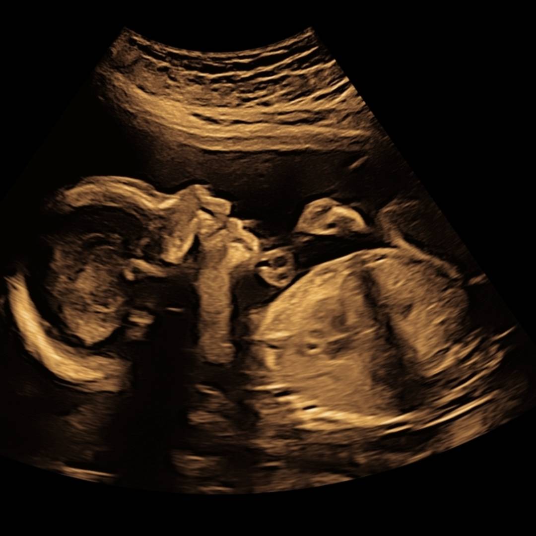 Photo shared by Autumn for their Babylist baby registry.