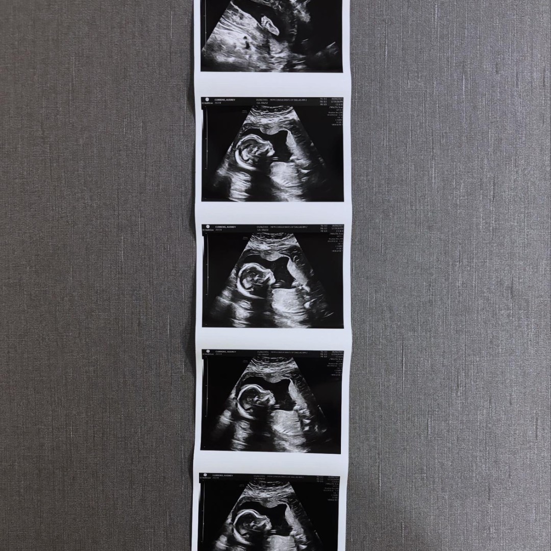 Photo shared by Audrey for their Babylist baby registry.