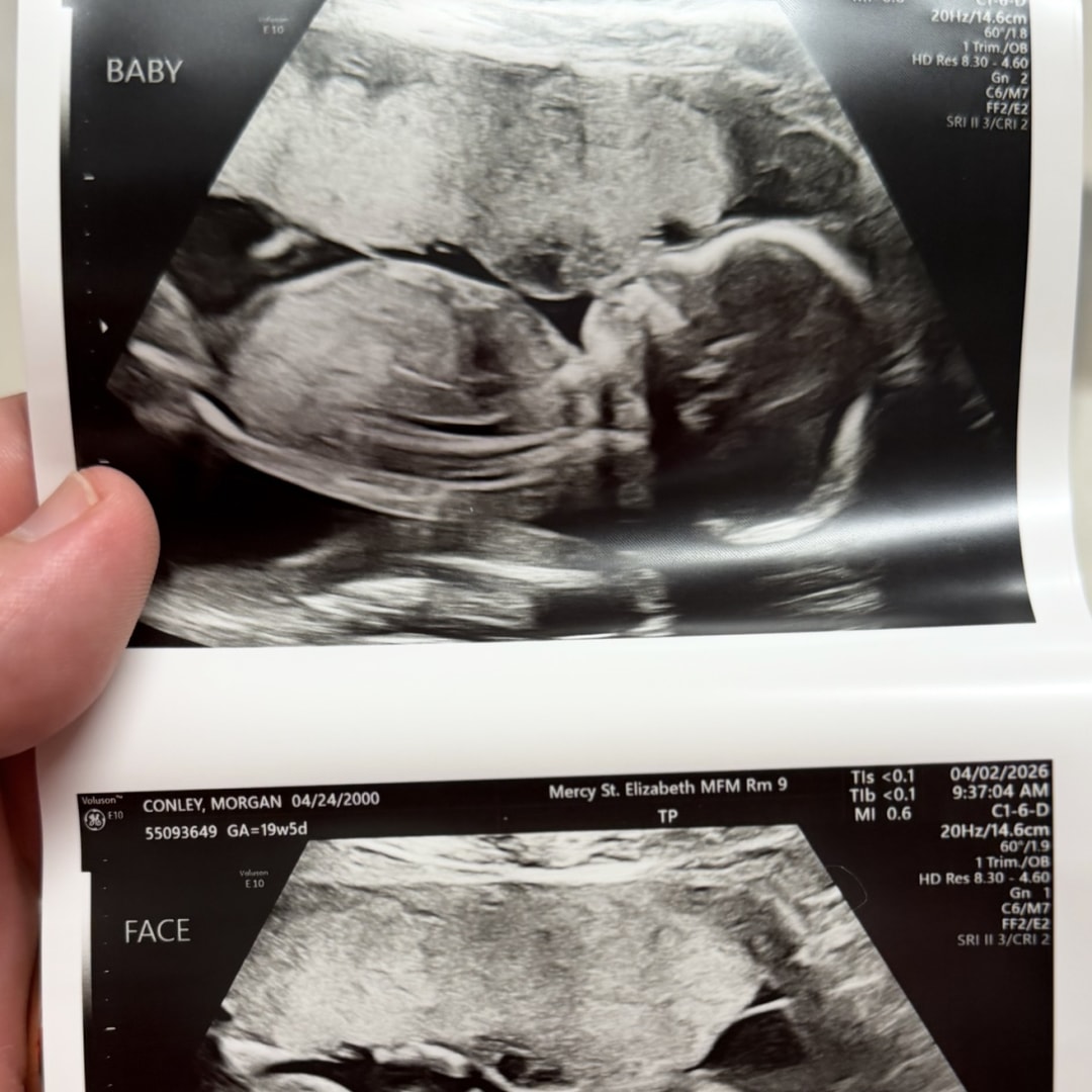 Photo shared by Morgan for their Babylist baby registry.