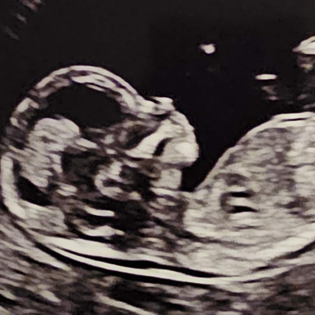 Photo shared by Sarah for their Babylist baby registry.