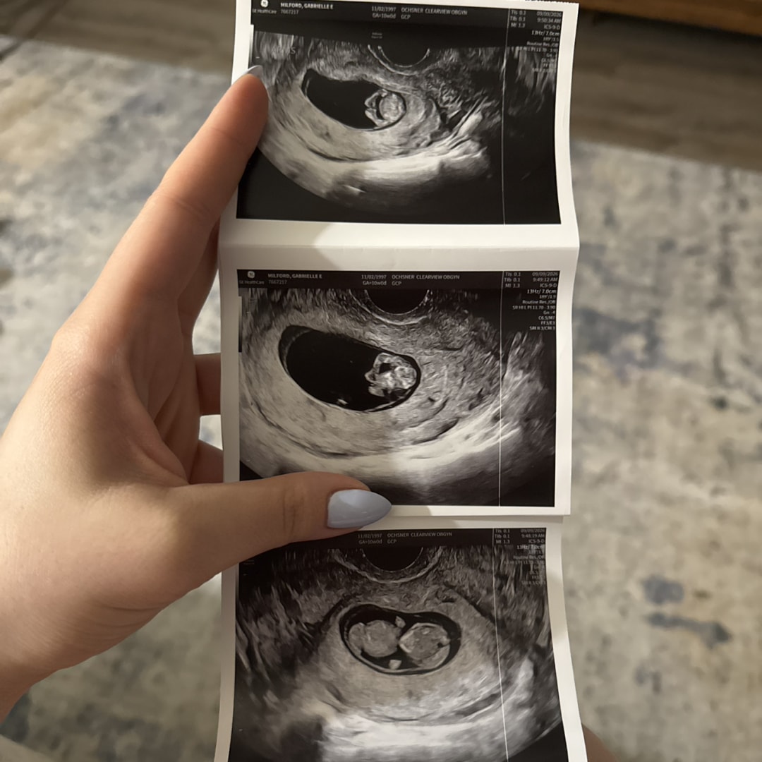 Photo shared by Gabrielle for their Babylist baby registry.