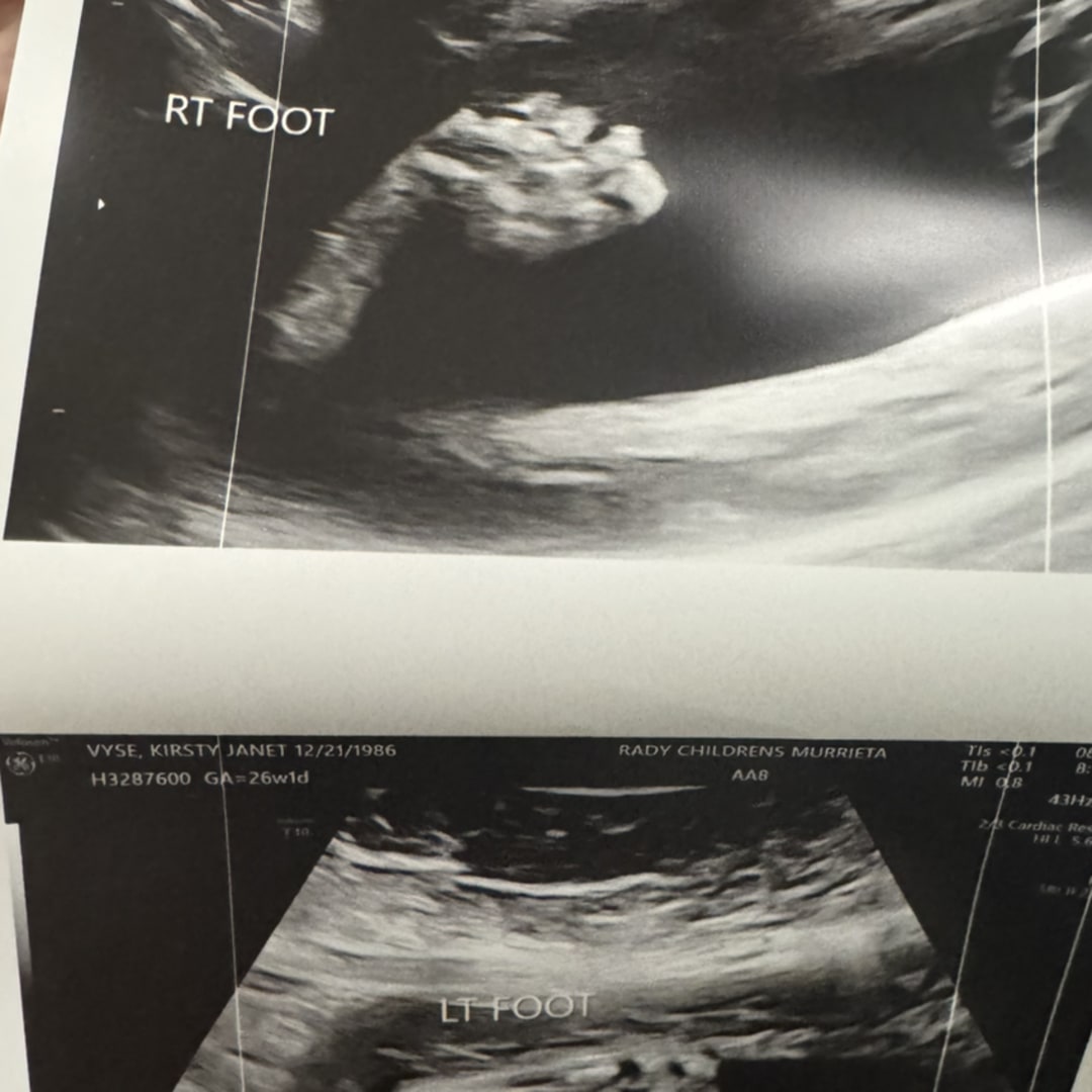 Photo shared by Kirsty for their Babylist baby registry.