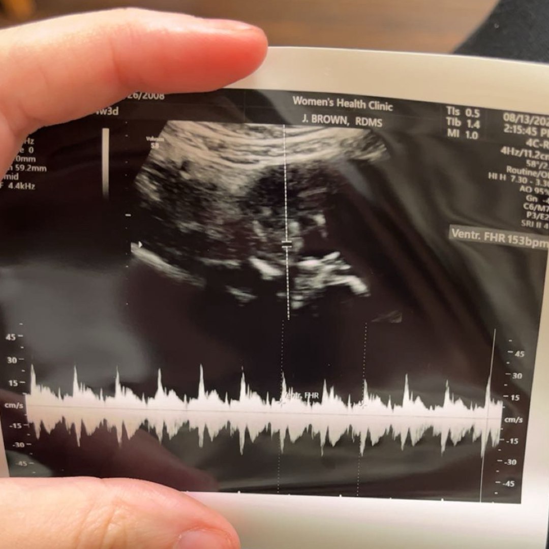 Photo shared by Mallory for their Babylist baby registry.