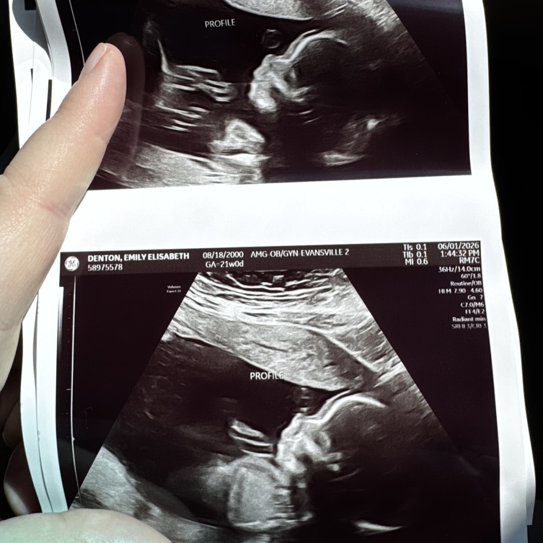 Photo shared by Emily for their Babylist baby registry.