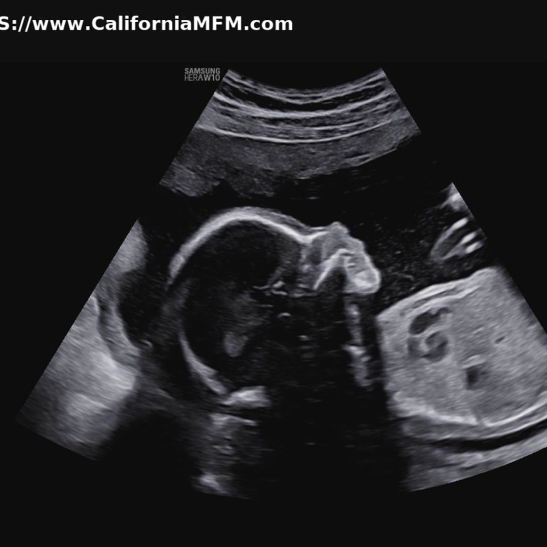 Photo shared by Avery for their Babylist baby registry.