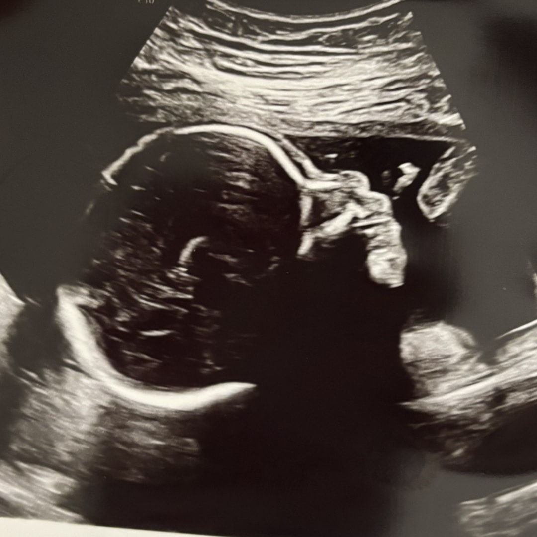 Photo shared by Jada for their Babylist baby registry.