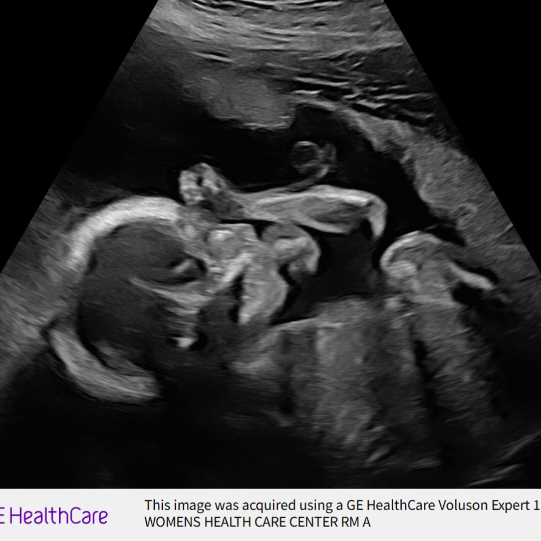 Photo shared by Hanna for their Babylist baby registry.