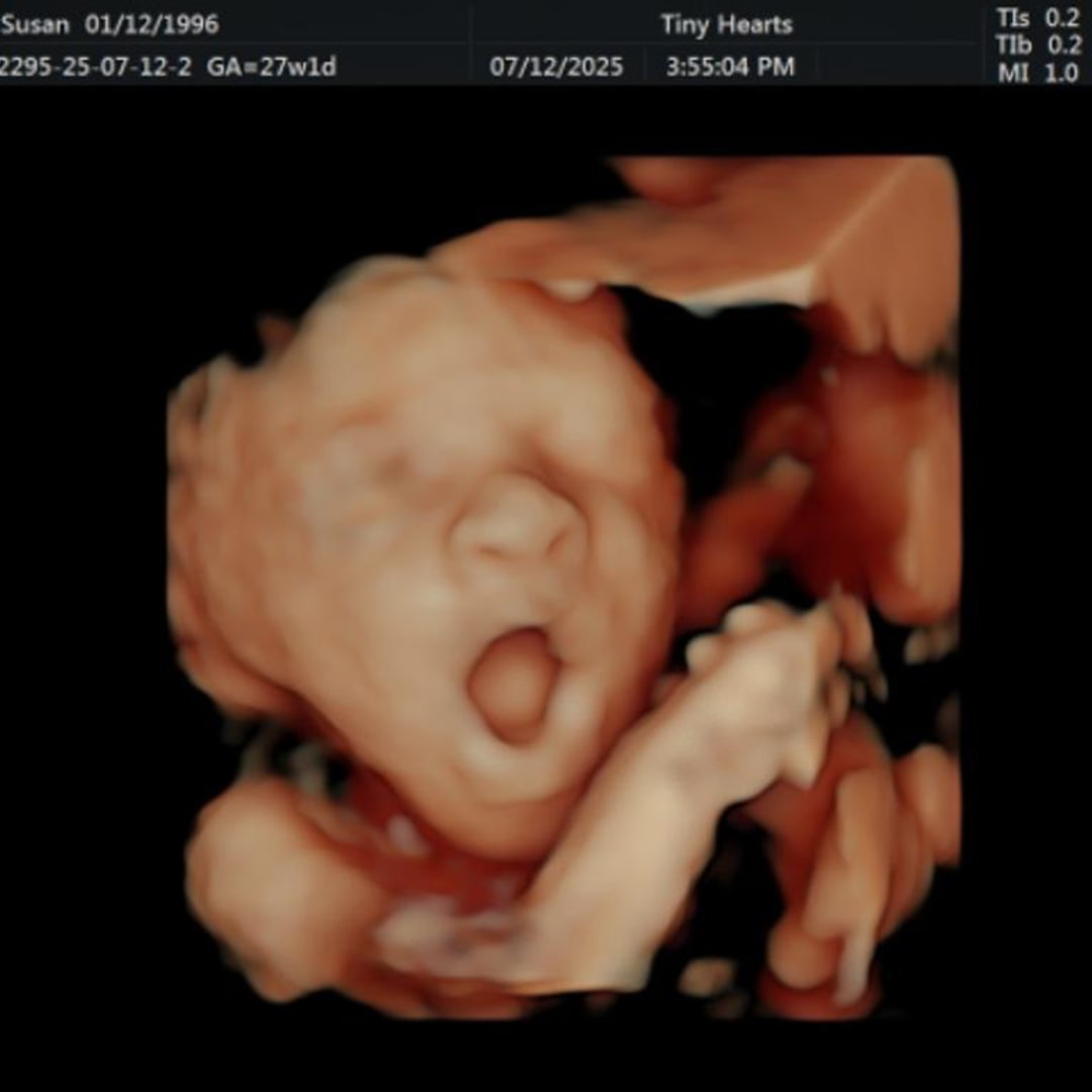 Photo shared by Susan for their Babylist baby registry.